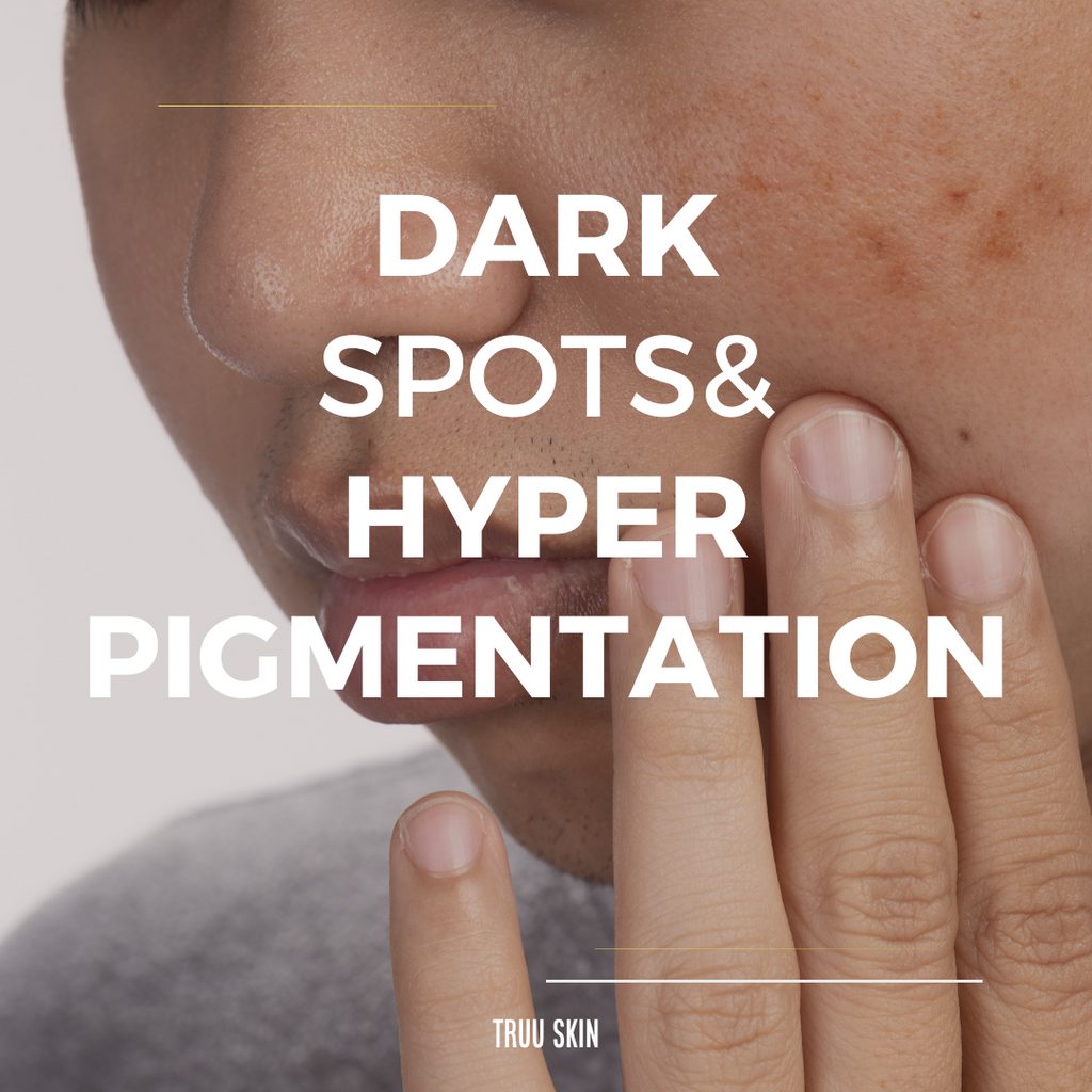 Winning the Battle against Dark Spots & Hyperpigmentation
