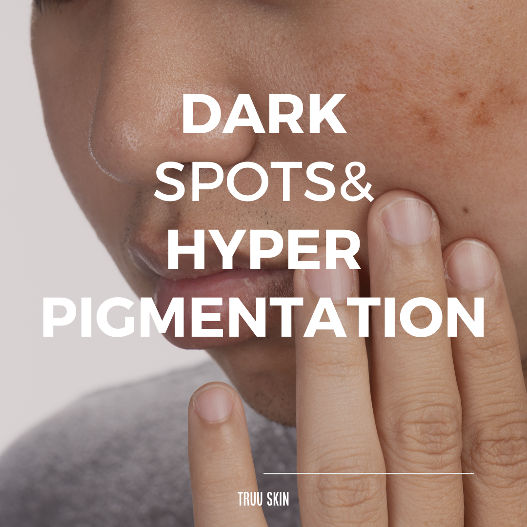 Skincare for Dark Spots and Hyperpigmentation – Truu Skin, LLC